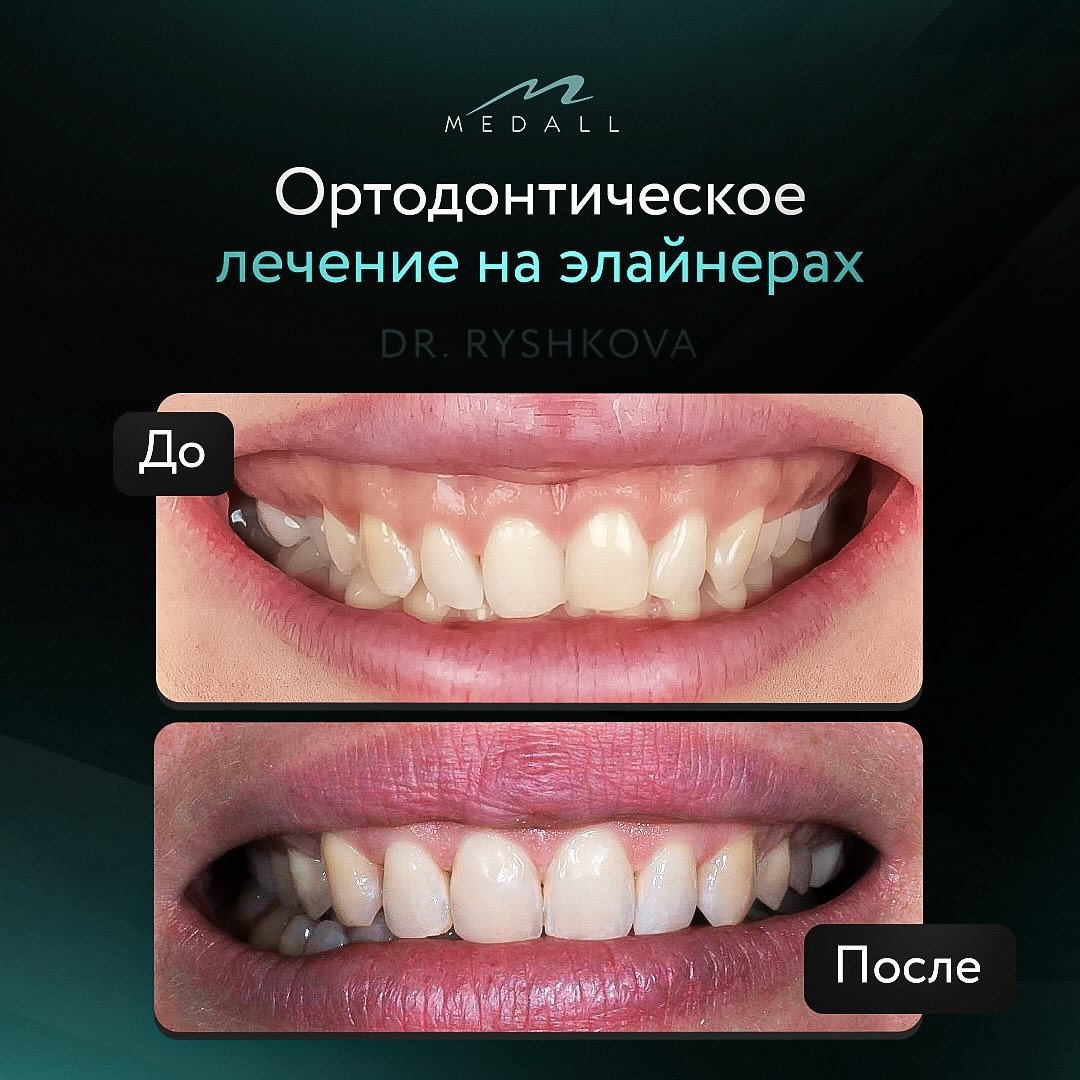 Работа выполнена ортодонтом Рышковой С.С.