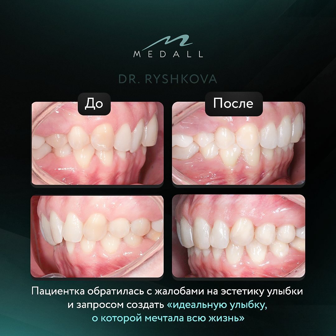 Работа выполнена ортодонтом Рышковой С.С.