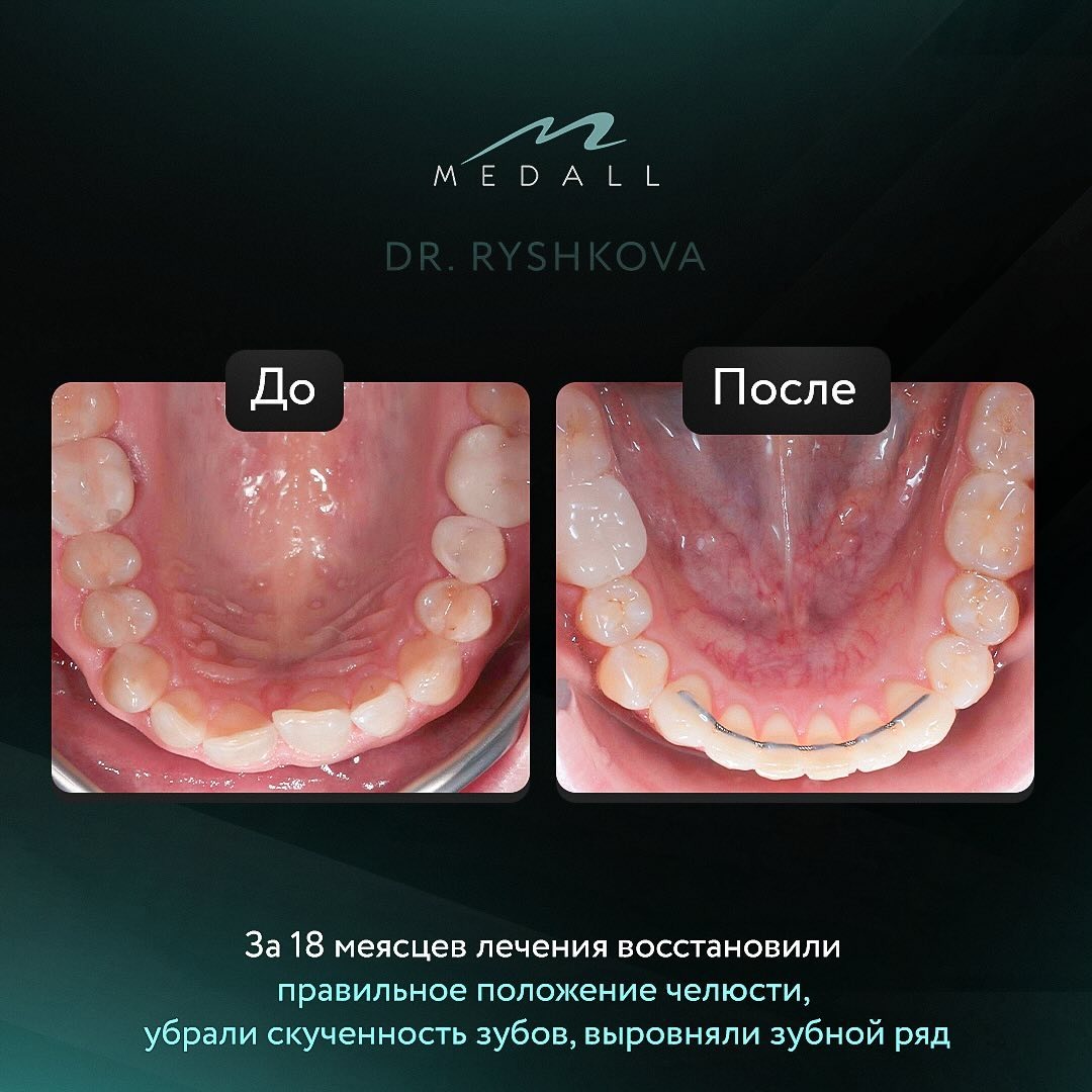 Работа выполнена ортодонтом Рышковой С.С.