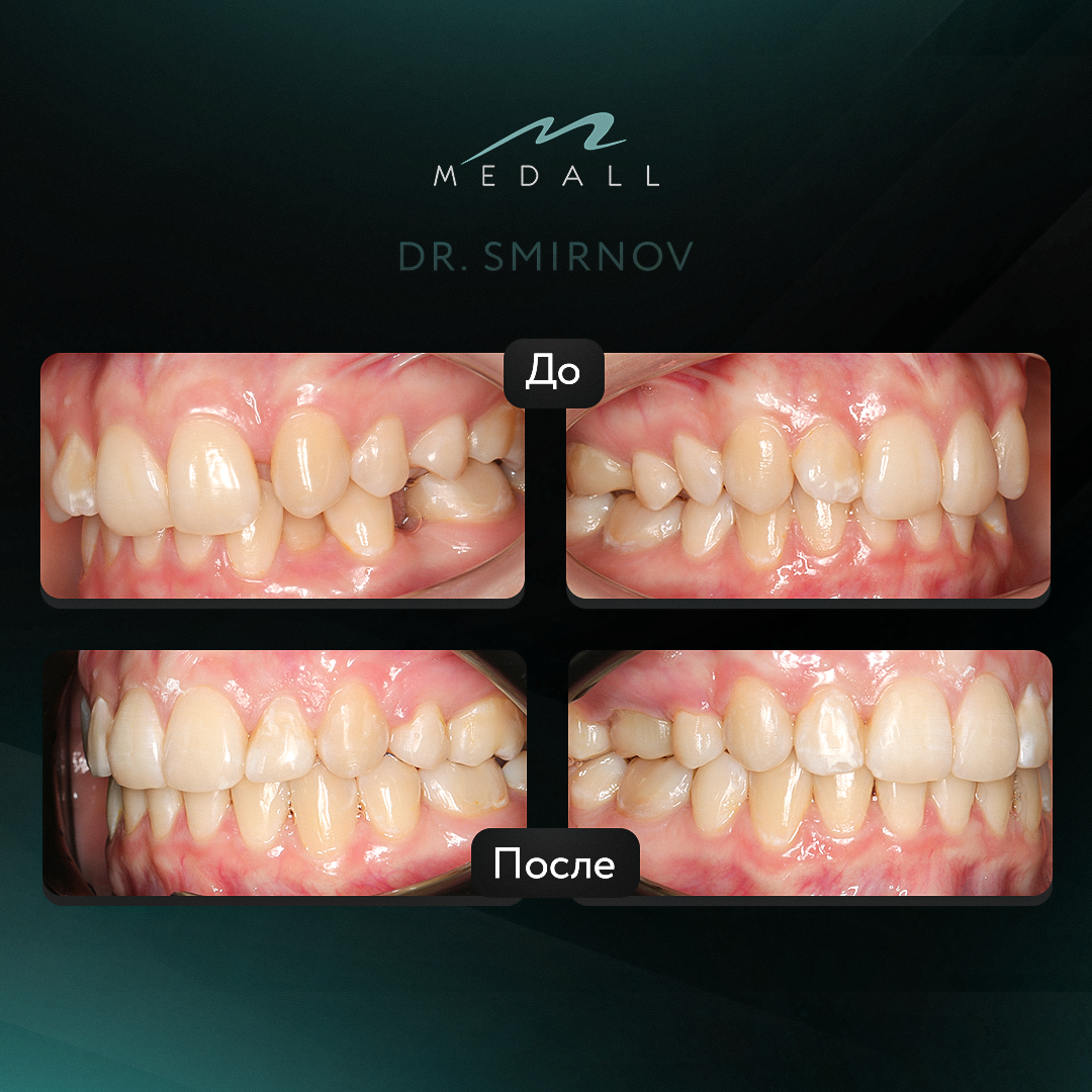 Работа выполнена ортодонтом Смирнова О.С.