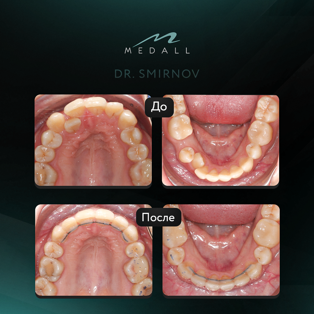 Работа выполнена ортодонтом Смирнова О.С.