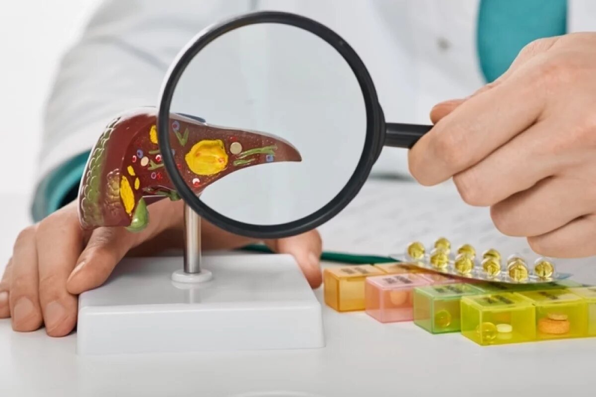    Сбой фильтра.