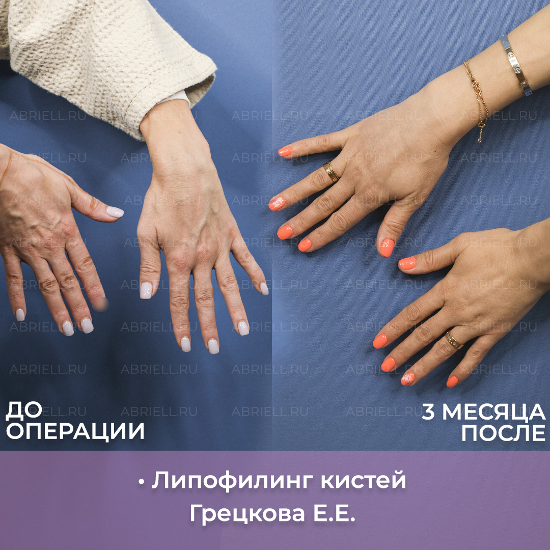 Хирург: Грецкова Е.Е.