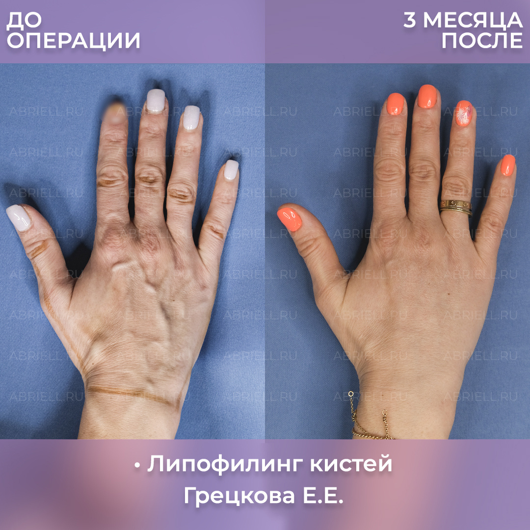 Хирург: Грецкова Е.Е.