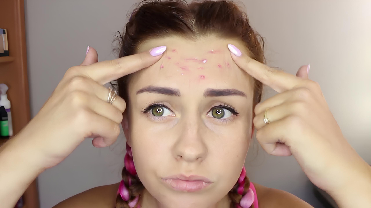 Эффективные методы: как избавиться от прыщей раз и навсегда