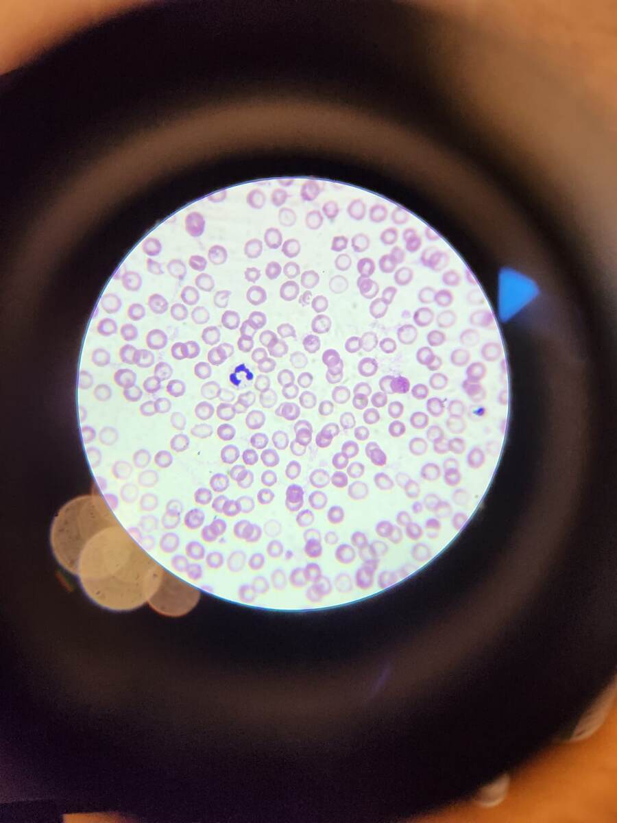 Мазок животного, редкое явления, когда все эритроциты оказались пустыми