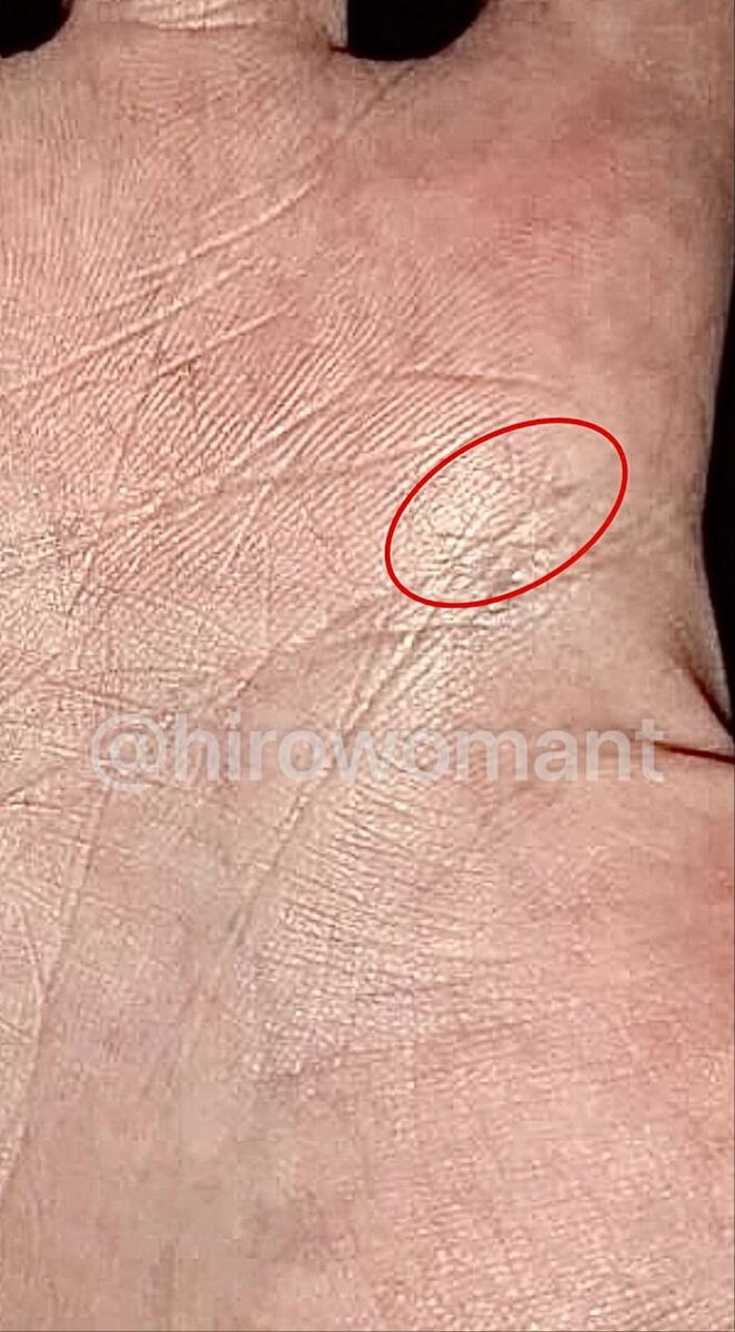 Знак ДТП на ладони