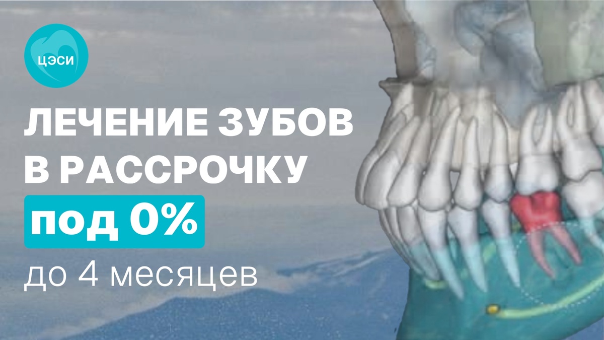 Когда обращаться к стоматологу?
Если вы заметили следующие симптомы, срочно обратитесь к врачу:
Усиление боли через 2–3 дня после удаления.
Повышенная температура тела.
Гнойные выделения из лунки.
Неприятный запах изо рта, не исчезающий после полосканий.
Клиника ЦЭСИ предоставляет полный комплекс услуг по удалению зубов, включая последующее наблюдение. Современное оборудование и опытные специалисты обеспечивают минимальный дискомфорт во время и после процедуры.
