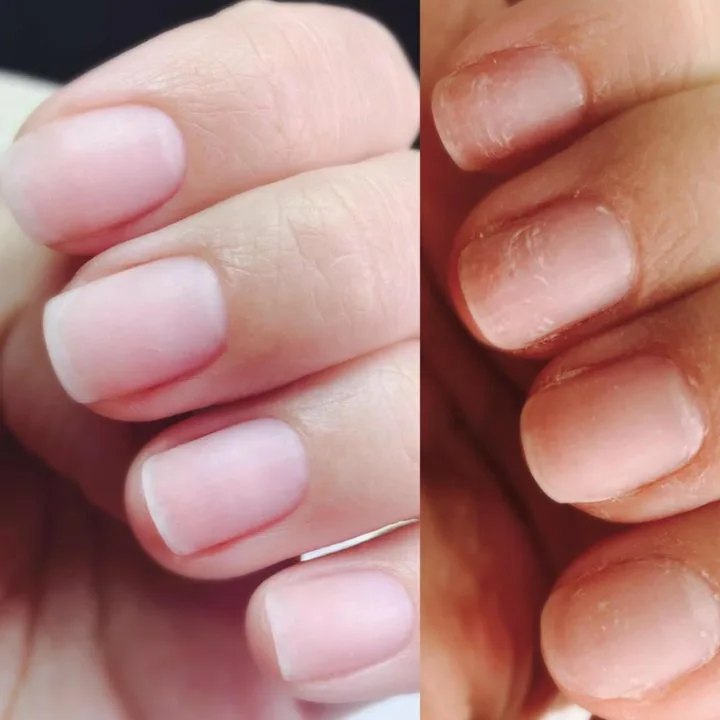 медицинский педикюр