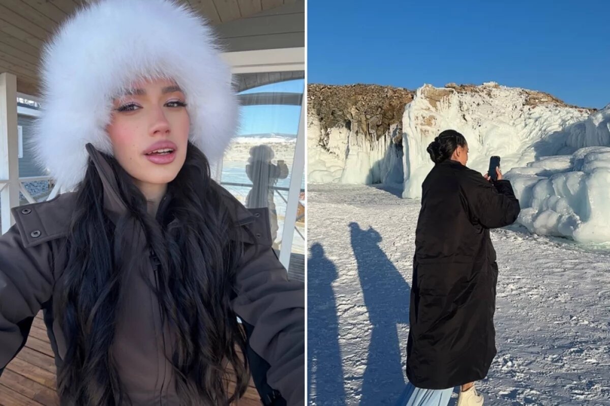 Алина загитова после пластики фото