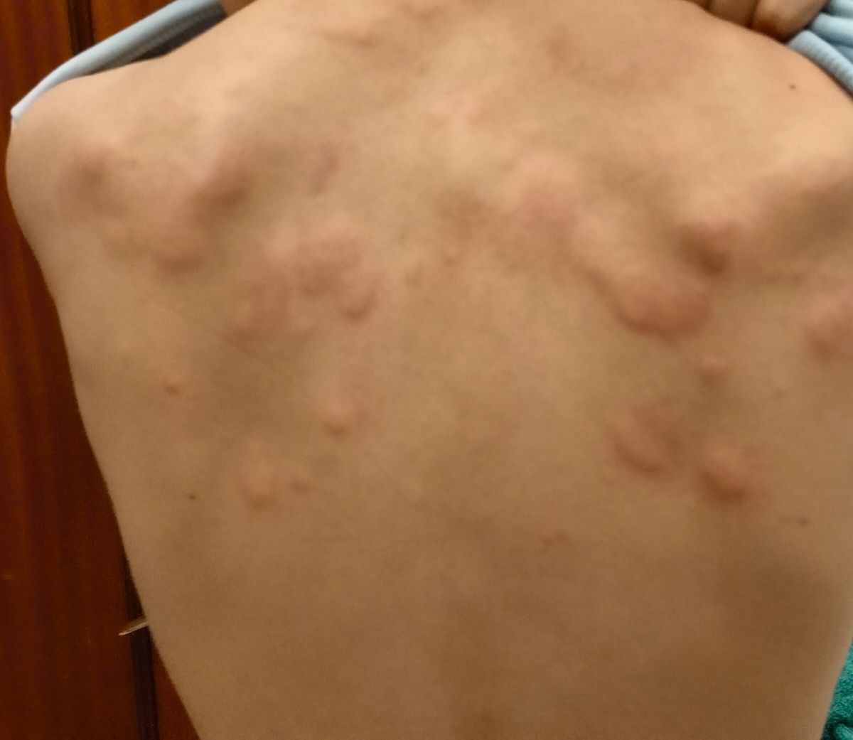 Это спина, да ещё и чешется