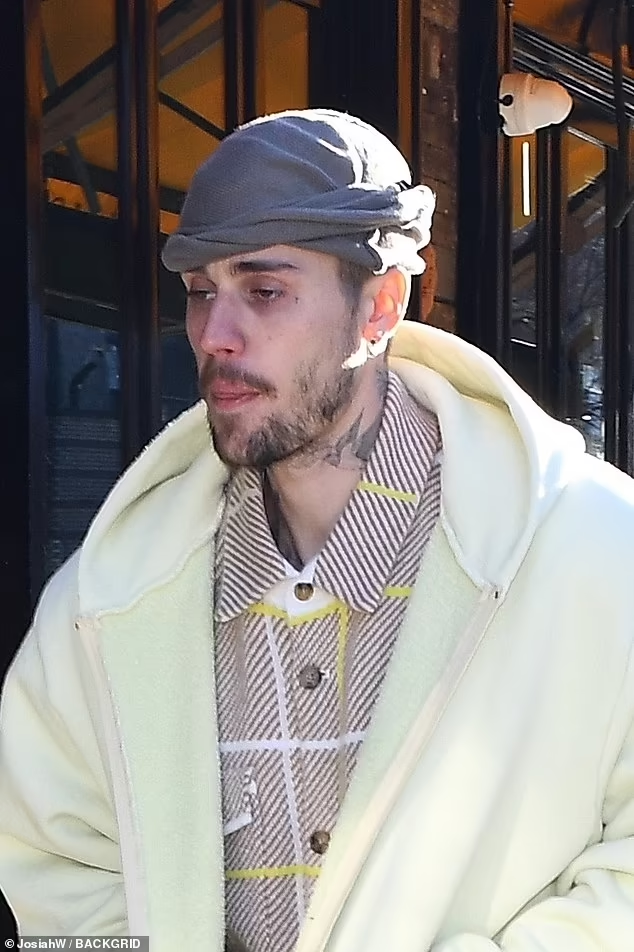 Джастин Бибер в последнее время вызывает всё большее беспокойство у своих поклонников. За последнюю неделю певца четыре раза видели в Нью-Йорке, и он выглядел заметно хуже, чем обычно
+
12
Просмотреть галерею
Джастин Бибер в последнее время вызывает всё большее беспокойство у своих поклонников. За последнюю неделю певца четыре раза видели в Нью-Йорке, и он выглядел заметно хуже, чем обычно