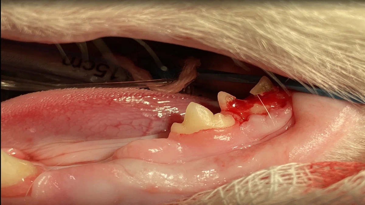 Разрушение зуба в результате резорбции - болезненное состояние