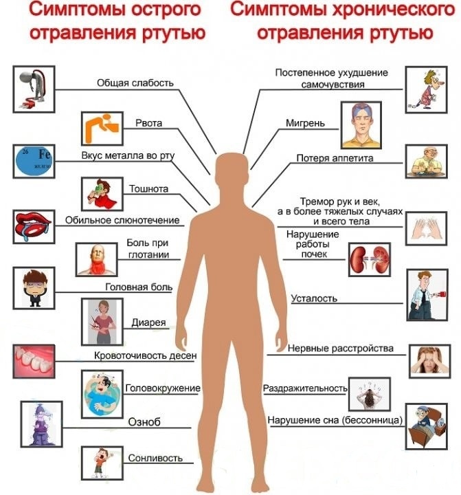 Симптомы отравления ртутью