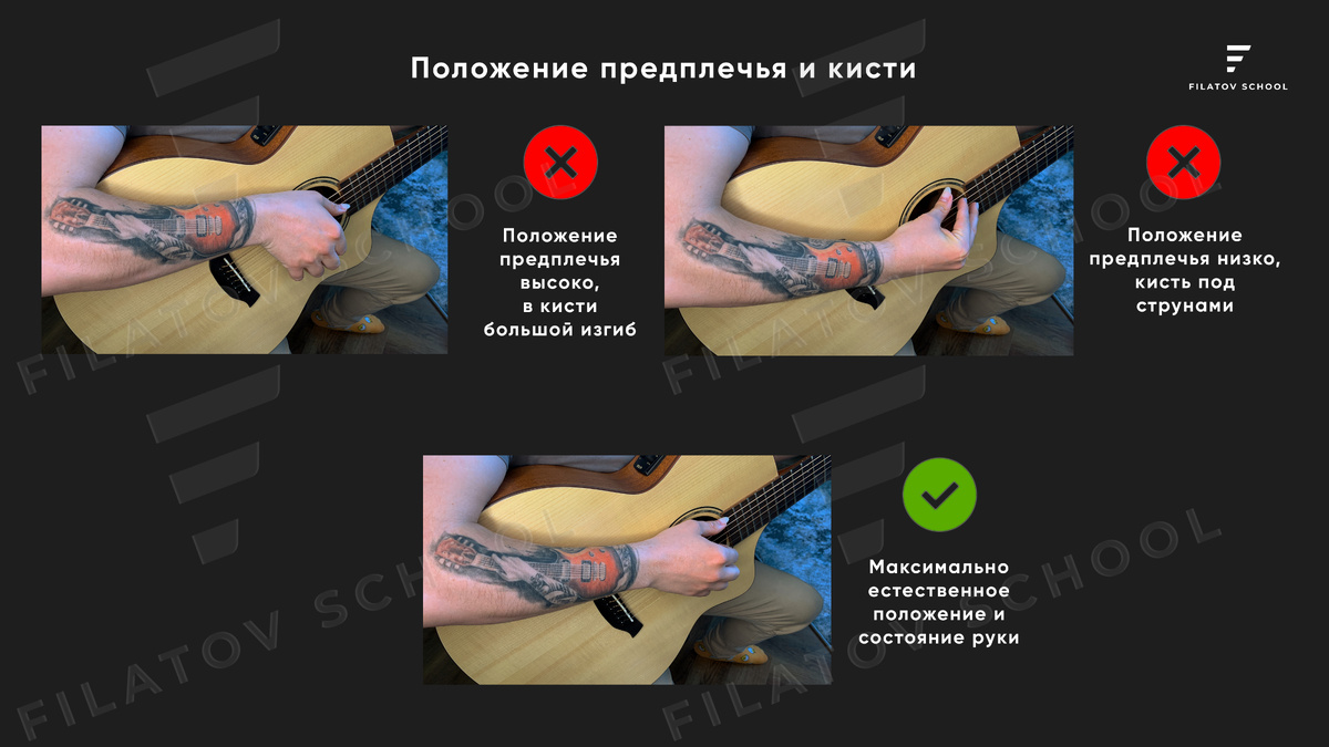 Вот так ставьте руку и она не будет болеть