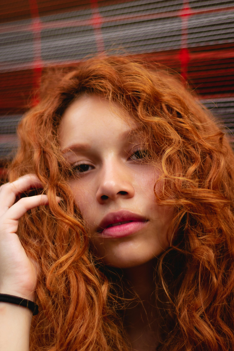 Почему появляется пигментация и тусклый цвет лица?