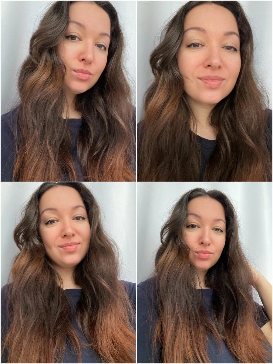 Моя кожа после ежедневного применения ниацинамид