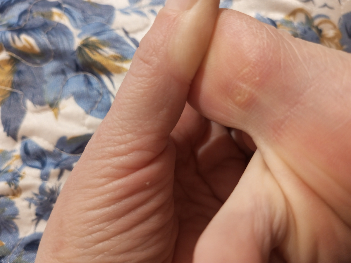 Личный архив/Фото "До"