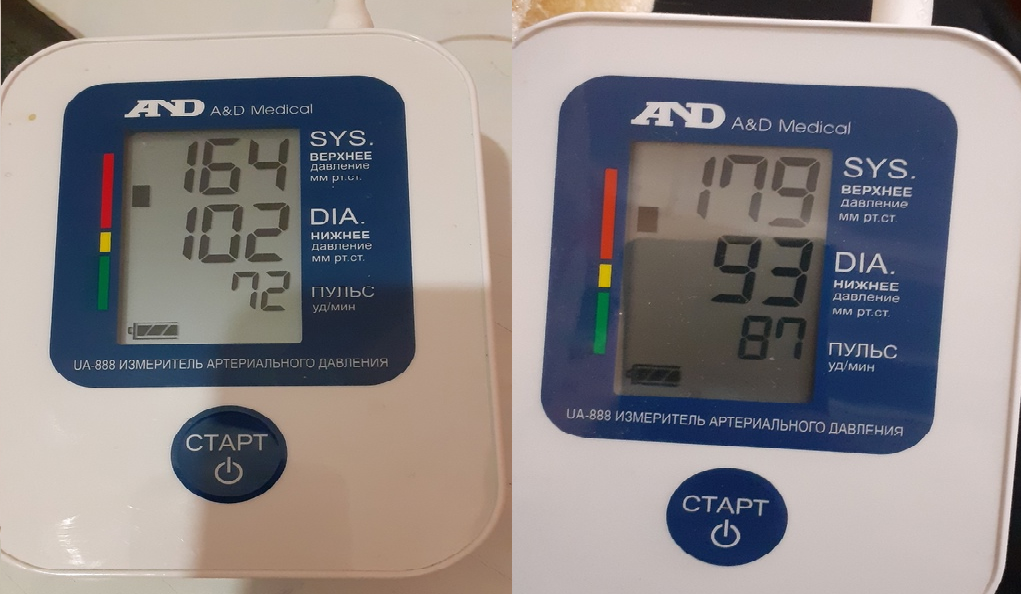 мое давление