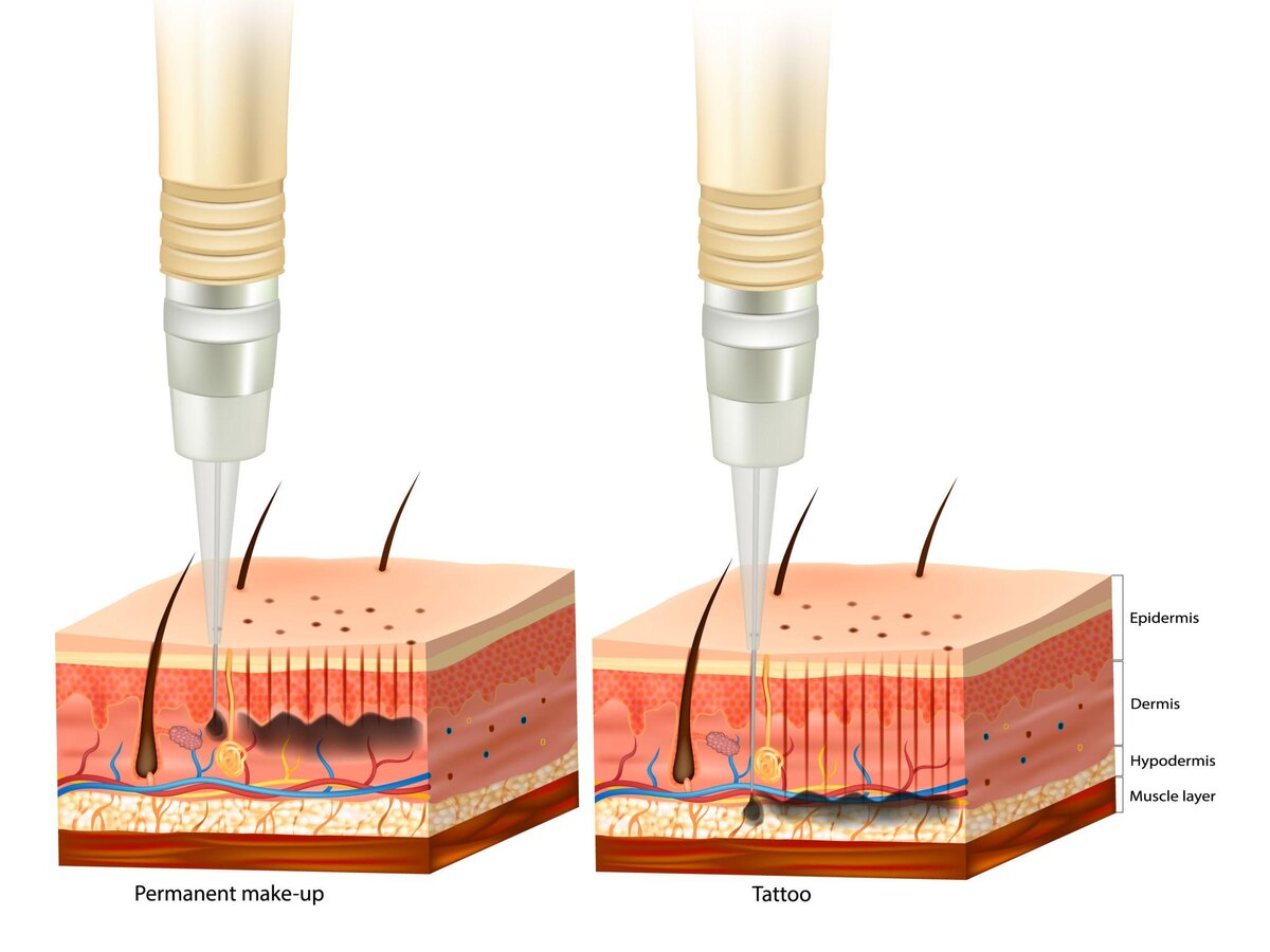 Глубина введения пигмента при перманентном макияже и татуировках