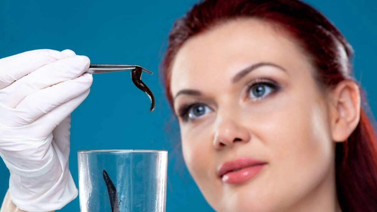    Лечение пиявками, или гирудотерапия — один из методов альтернативной медицины / Фото: Shutterstock