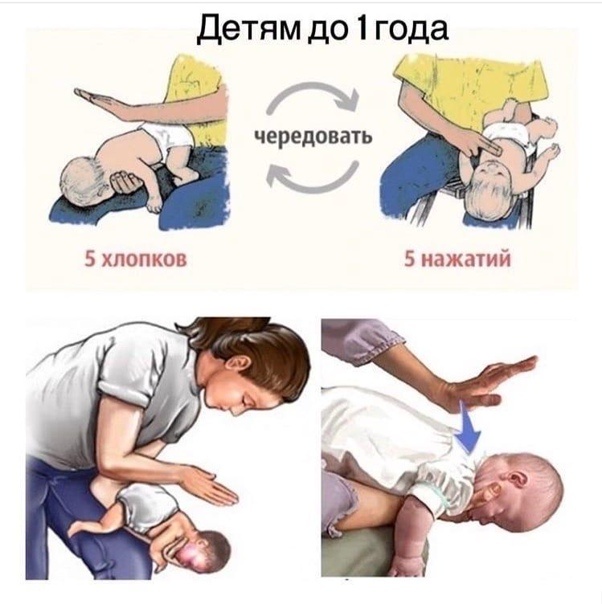 Первая помощь, если ребенок подавился