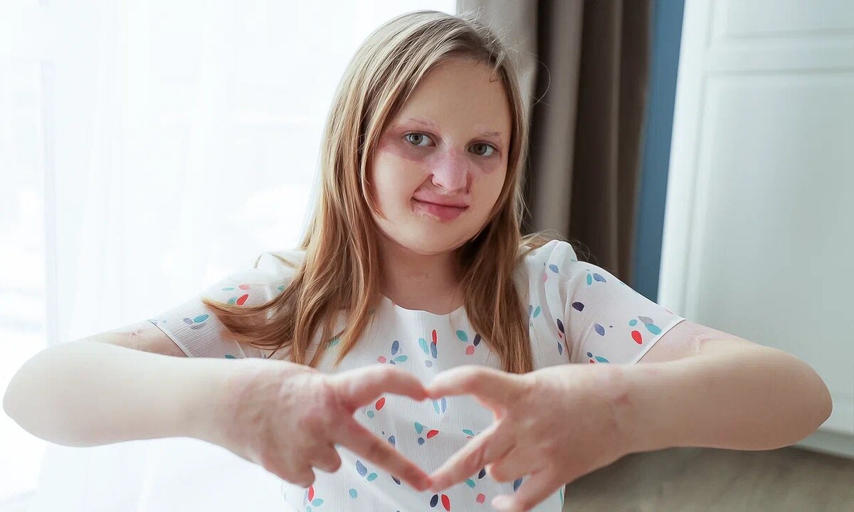 Дария Терентьева, подопечная фонда «Алёша»