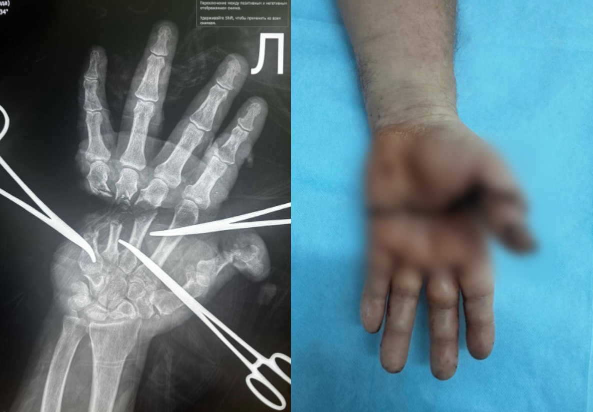 Фото минздрава НСО.