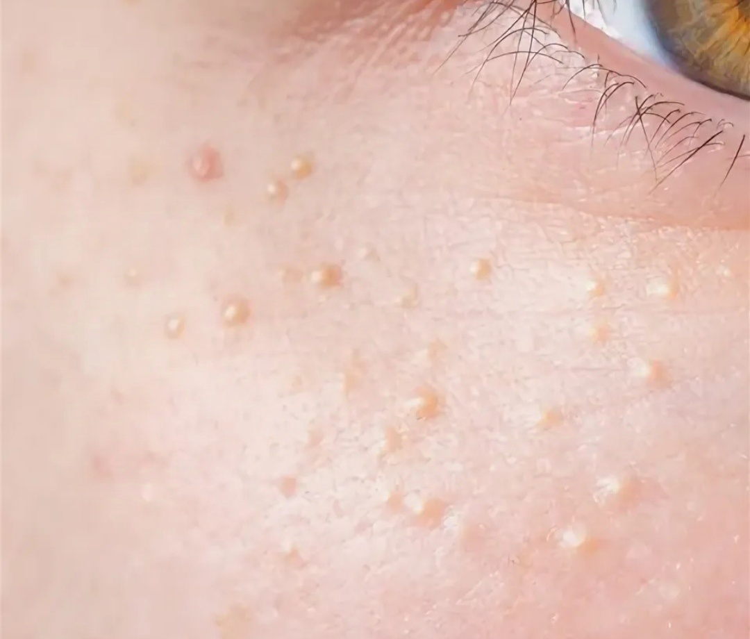 Скриншот сделан с Яндекс картинки для наглядности примера 