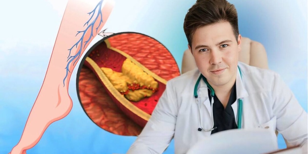 9 признаков высокого холестерина, которые не стоит игнорировать, и 6 способов управления уровнем холестерина