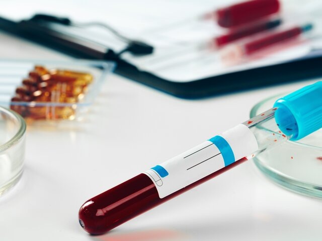    Фото: 123RF/fabrikacrimea