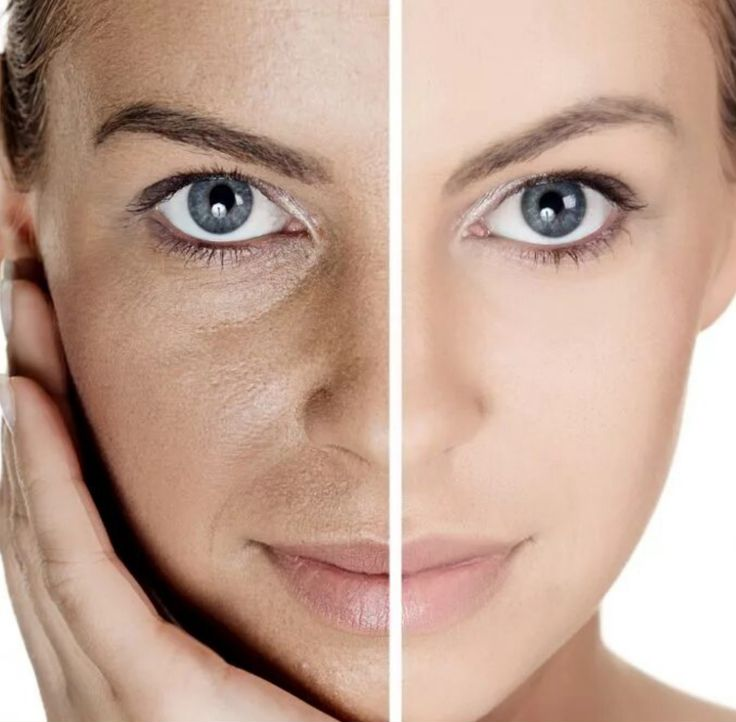 Ретинол: очередное чудо-средство в уходе за кожей?