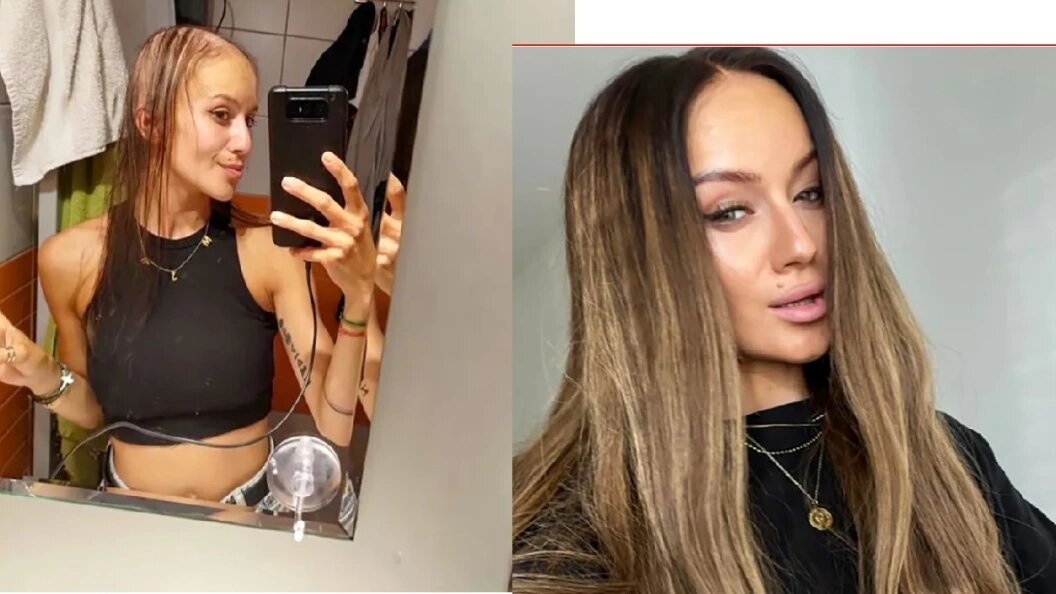    На этих снимках видно, как Барбора Кропакова выглядела до и после операции по увеличению груди. Фото: соцсети