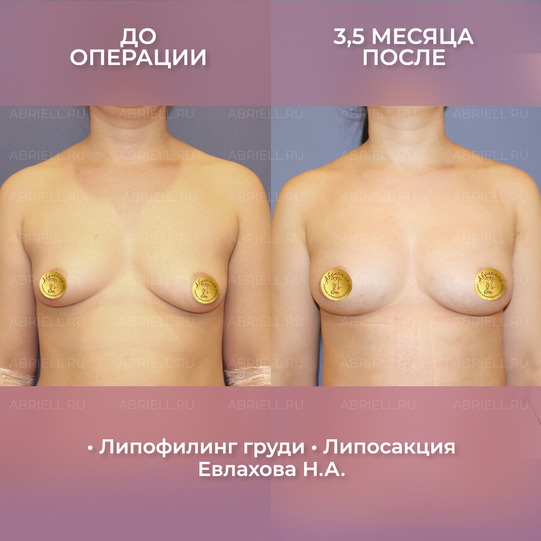 Хирург: Евлахова Н.А. 