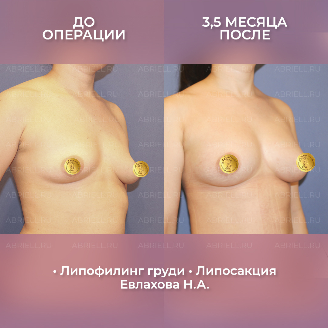 Хирург: Евлахова Н.А. 