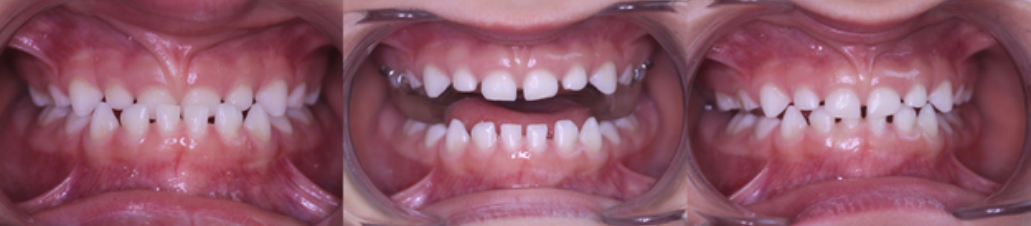 Клинический случай Доктора Бен Юнес-Узан, Франция.