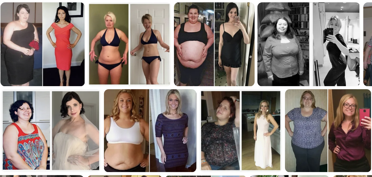 До/после в любых вариантах скачивается за секунду и бесплатно.