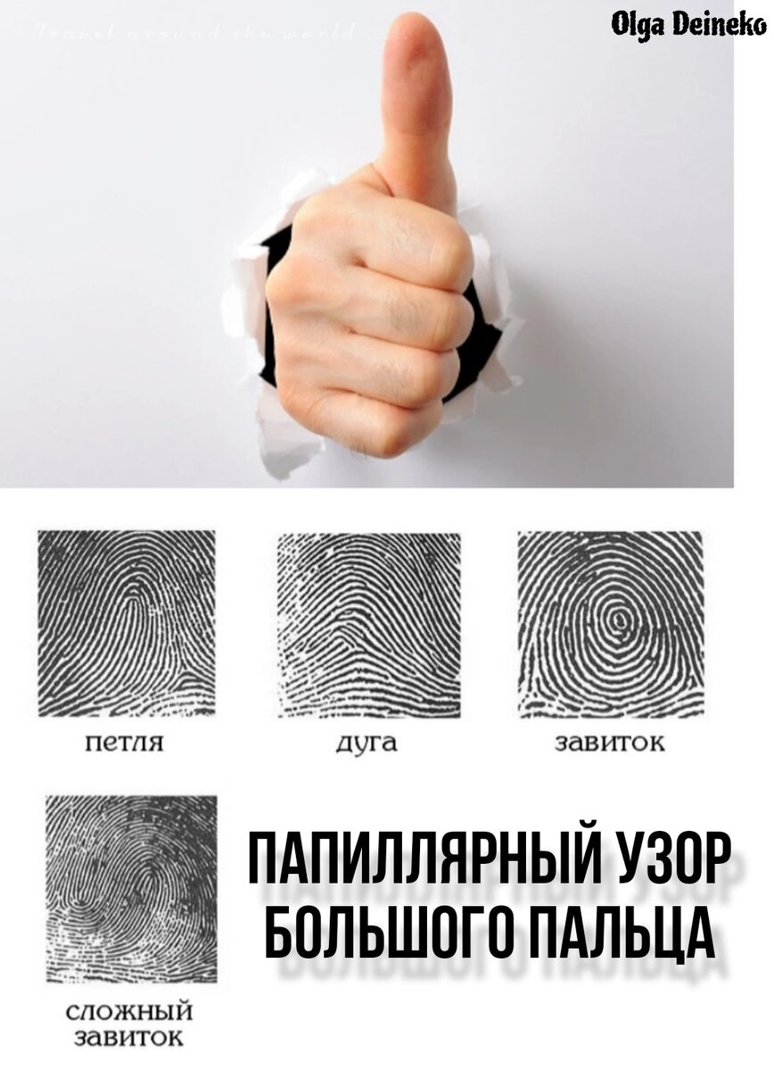 Виды папиллярного узора на большом пальце. Фото автора.
