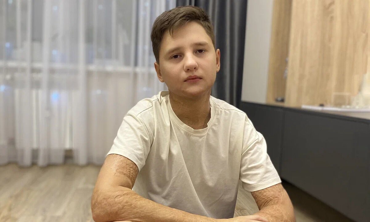 Егор Васильев, подопечный фонда «Алёша»