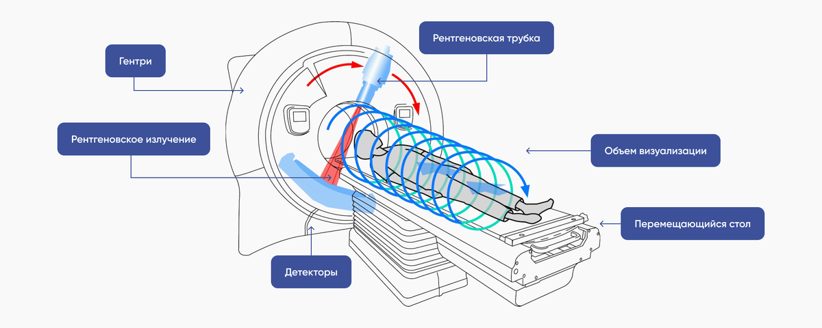 Устройство компьютерного томографа