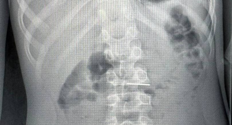    Пресс-служба Министерства здравоохранения Московской области