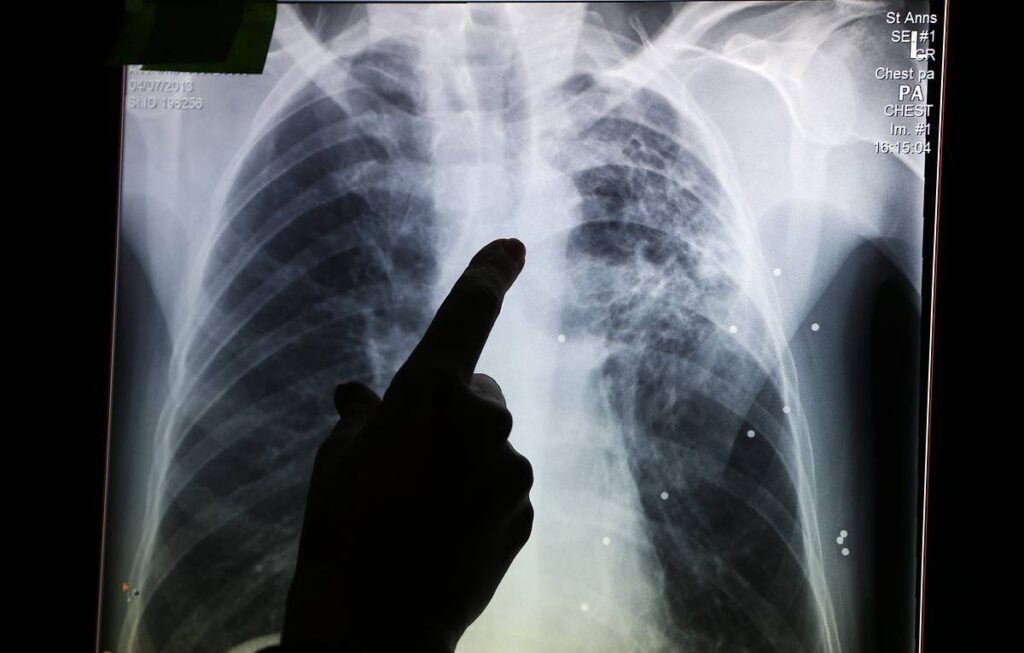    Фото: AP Photo / Lefteris Pitarakis Екатерина Устькачкинцева