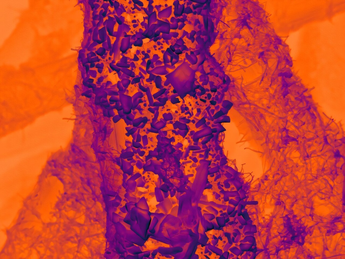 Частицы олова на нанотекстурированной углеродной подложке служат эффективным электрокатализатором для преобразования CO2 в ценные продукты.    
 Источник: University of Nottingham  📷
