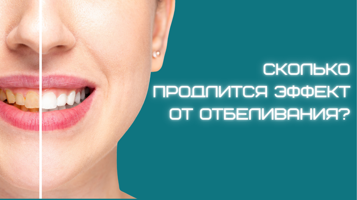 Как можно пролонгировать эффект процедуры отбеливания зубной эмали?