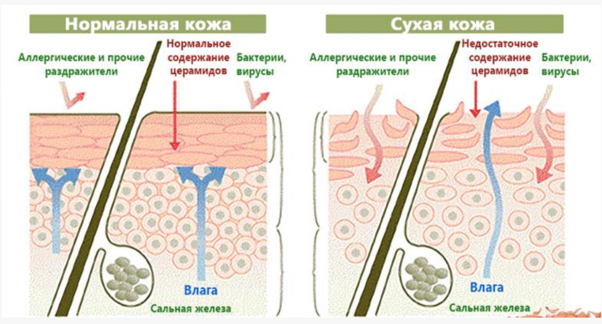 Какие признаки характерны: мелкие шелушения, прозрачного или белого цвета, с рваными краями.