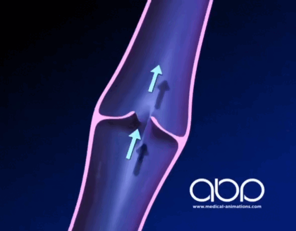 Клапаны перестали выполнять свою функцию и кровь стала забрасываться обратно 