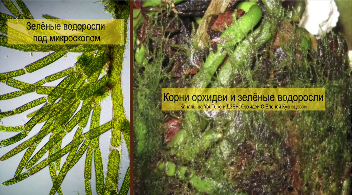 Зеленые водоросли под микроскопом