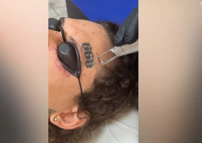 Процесс удаления шестерок