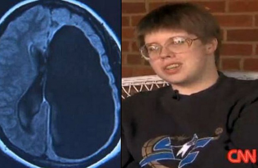 Мишель Мак - девушка с половиной мозга