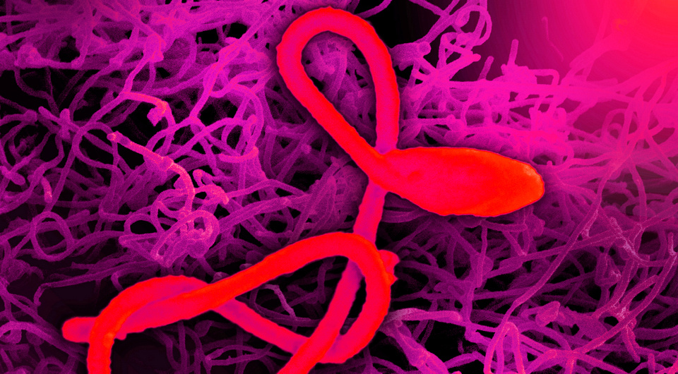   NIAID / Flickr / CC BY 2.0